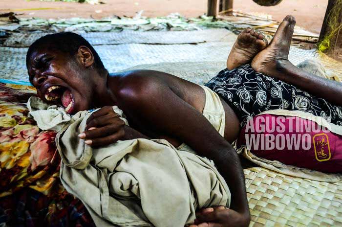 Seorang gadis yang mengalami kelumpuhan setelah terjatuh dari rumah panggung (AGUSTINUS WIBOWO)