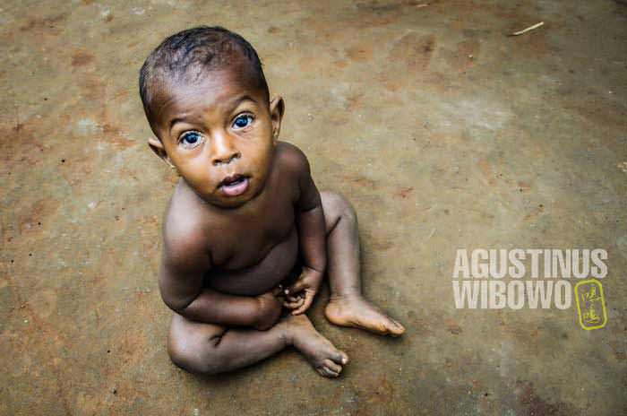 Sejumlah besar warga Tais adalah bayi dan anak-anak (AGUSTINUS WIBOWO)