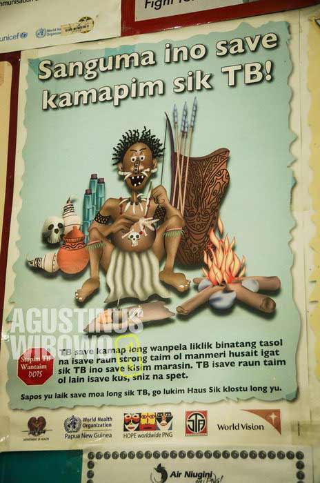 Poster pesan sosial: "Sanguma (penyihir) tidak bisa menyebabkan penyakit TBC" (AGUSTINUS WIBOWO)